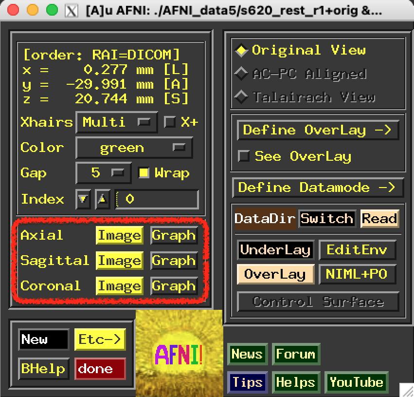 ../../_images/afni_controller_window_image_graph.png