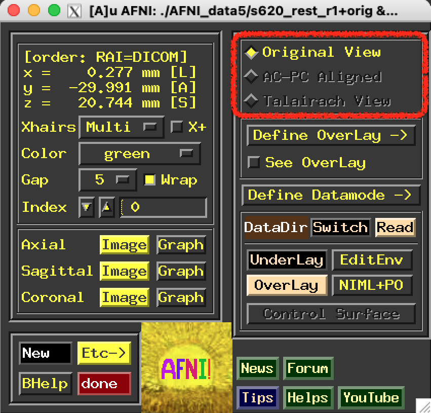 ../../_images/afni_controller_window_view.png