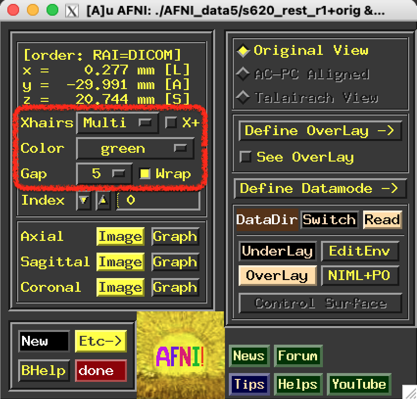 ../../_images/afni_controller_window_xhairs.png