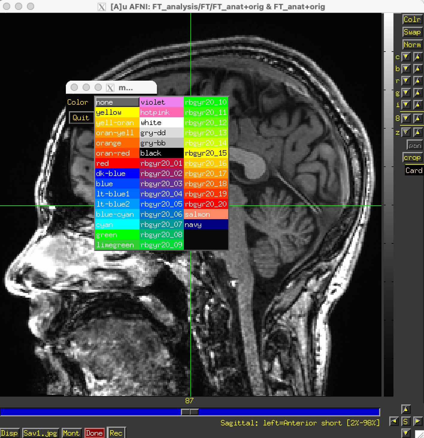 ../../_images/image_window_IntensityBar_Popup_zero_color_cont.png