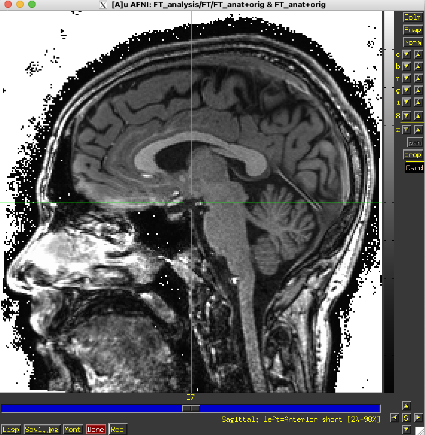 ../../_images/image_window_IntensityBar_Popup_zero_color_white.png