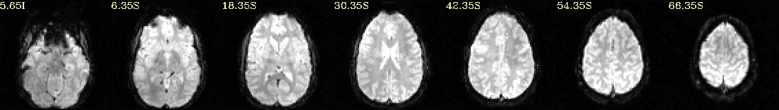 media/qc_00_vorig_EPI.axi.jpg
