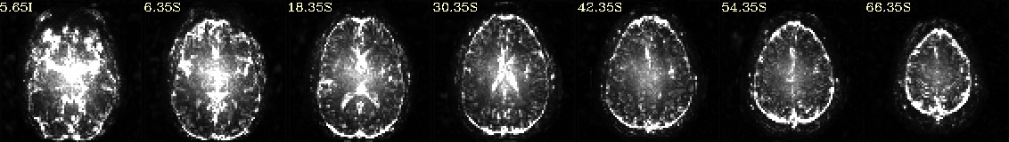 media/qc_01_vorig_EPI_variance.axi.jpg