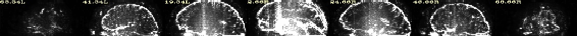 media/qc_01_vorig_EPI_variance.sag.jpg