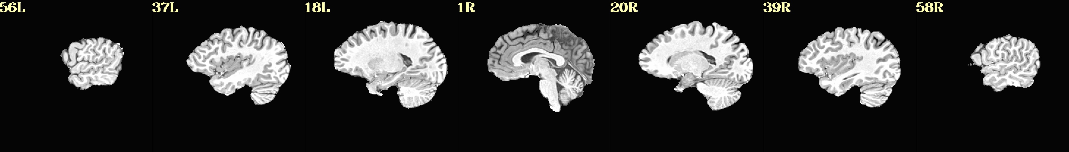 media/qc_02_vorig_anat.sag.jpg