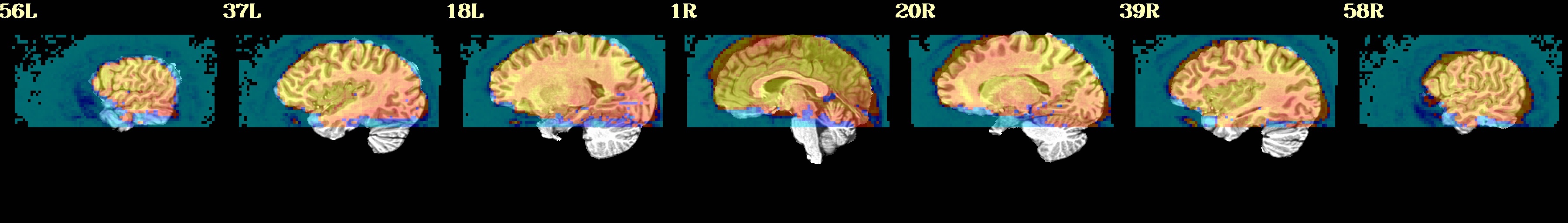 media/qc_03_vorig_olap.sag.jpg