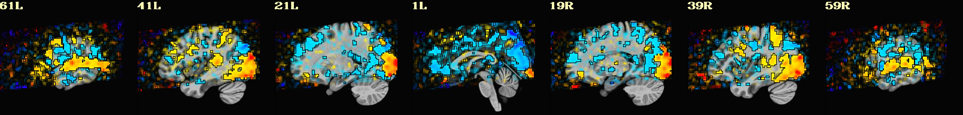 media/qc_08_vstat_vis_0_Coef.sag.jpg