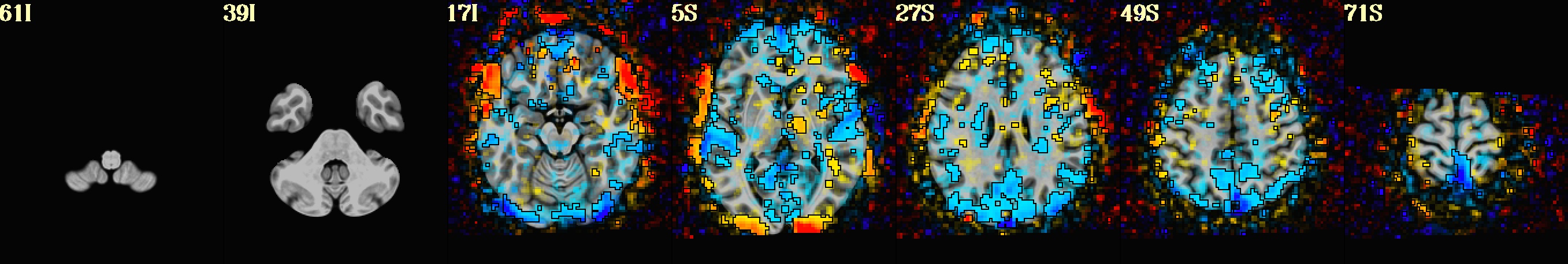 media/qc_10_vstat_V-A_GLT_0_Coef.axi.jpg