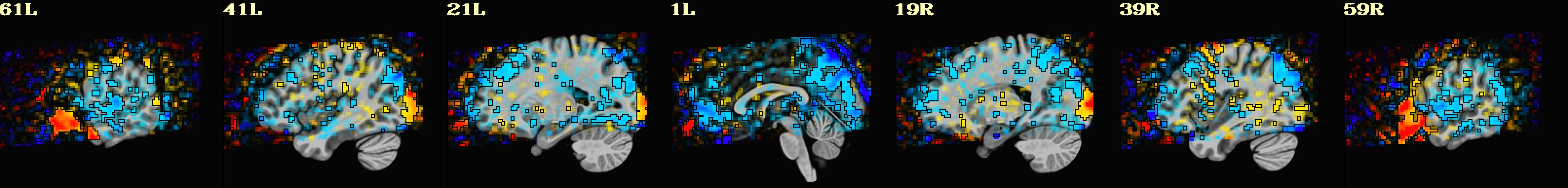 media/qc_10_vstat_V-A_GLT_0_Coef.sag.jpg