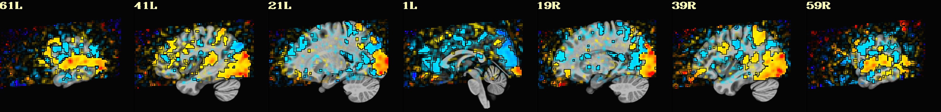 media/qc_11_vstat_mean.VA_GLT_0_Coef.sag.jpg