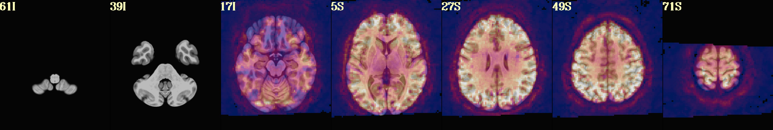 media/qc_19_regr_tsnr_vreg.axi.jpg