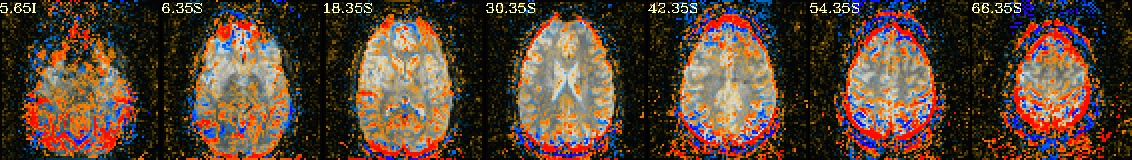 media/qc_22_radcor_rc_tcat_r01.axi.jpg