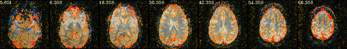 media/qc_22_radcor_rc_tcat_r02.axi.jpg