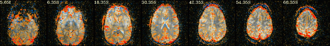 media/qc_22_radcor_rc_tcat_r03.axi.jpg