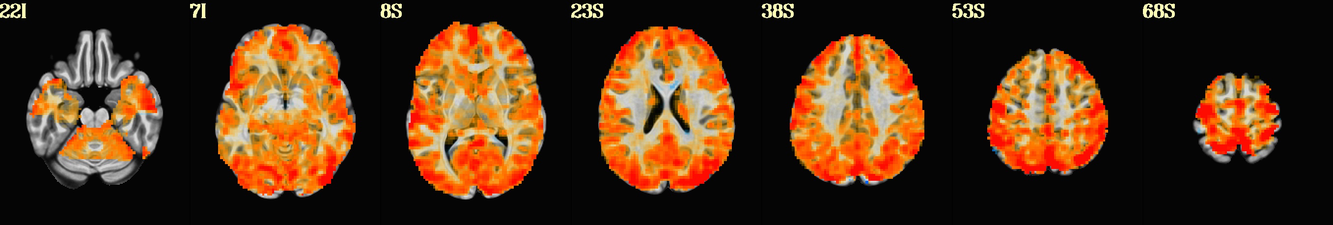 media/qc_24_radcor_rc_regress_d01.axi.jpg
