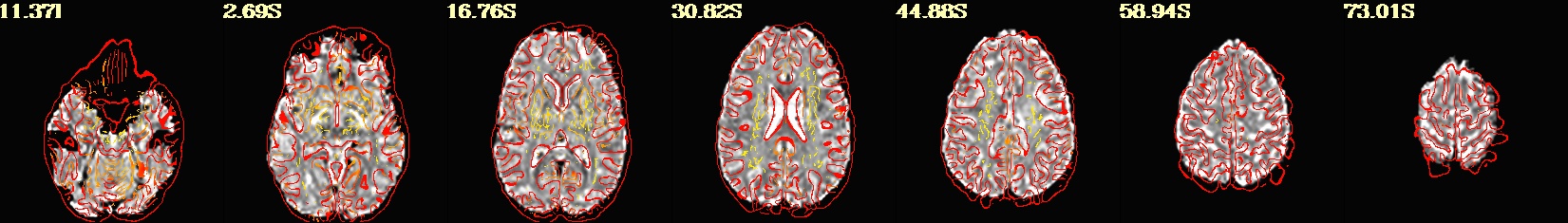 media/qc_30_warns_flip_1.axi.jpg