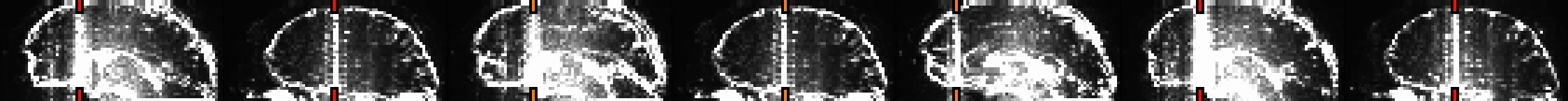 media/qc_31_warns_vlines_0.sag.jpg