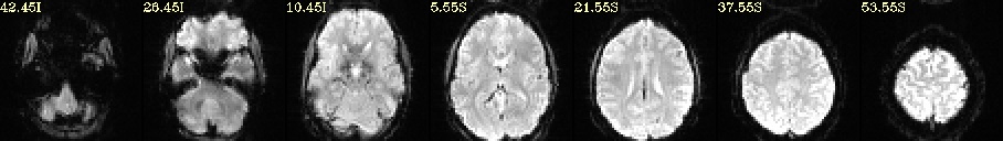 media/qc_00_vorig_EPI.axi.jpg