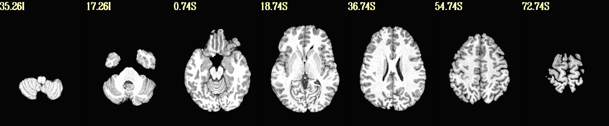 media/qc_01_vorig_anat.axi.jpg