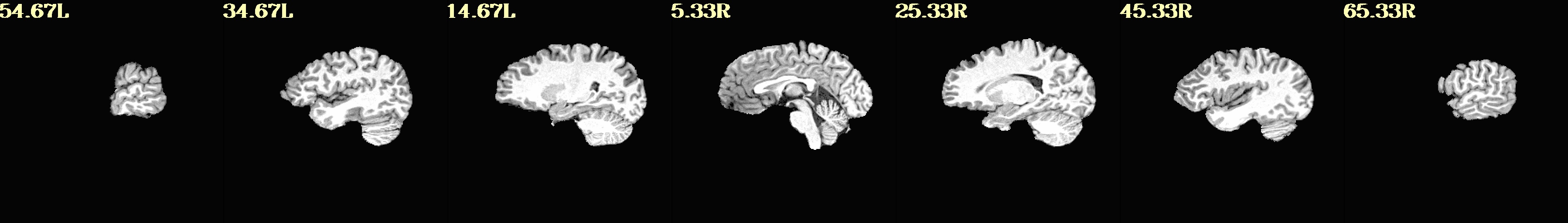 media/qc_01_vorig_anat.sag.jpg