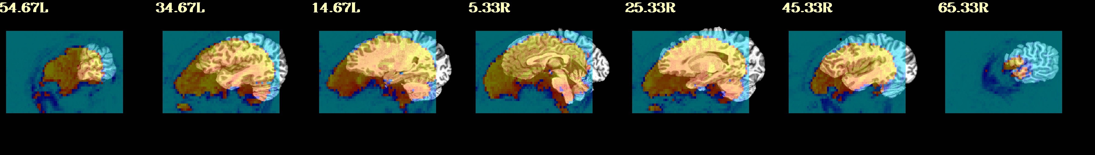 media/qc_02_vorig_olap.sag.jpg