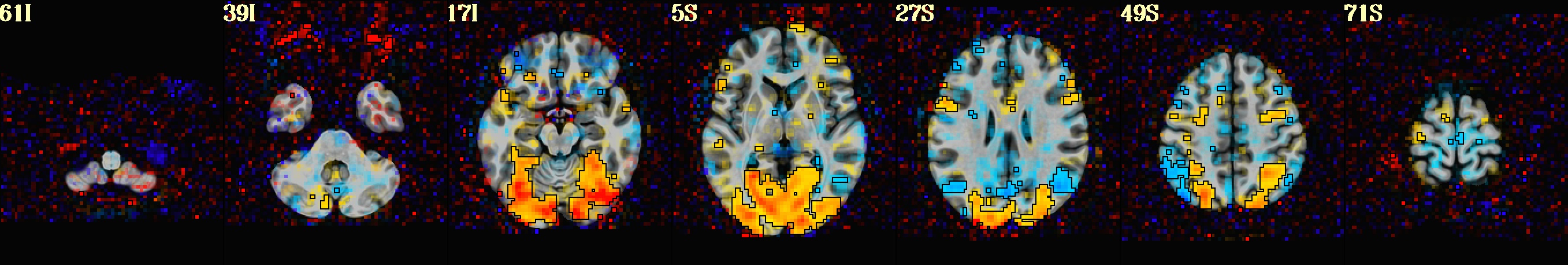 media/qc_08_vstat_TASK_0_Coef.axi.jpg
