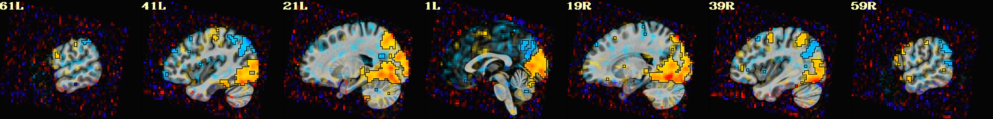 media/qc_08_vstat_TASK_0_Coef.sag.jpg