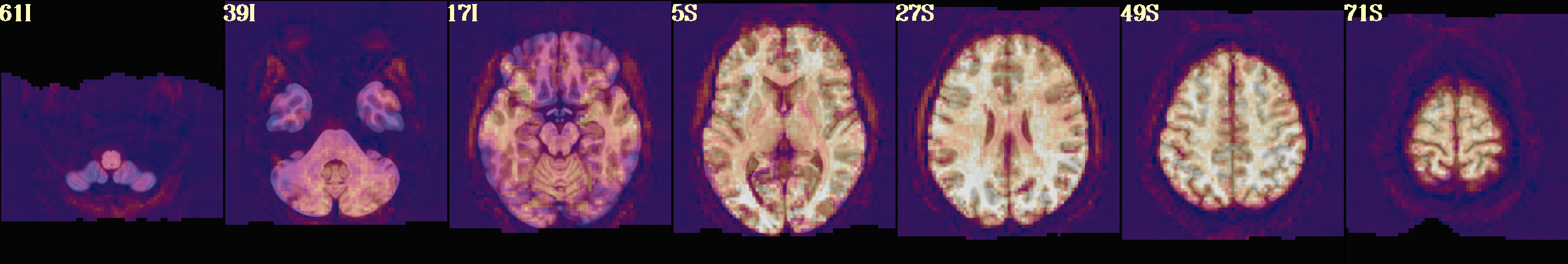 media/qc_16_regr_tsnr_vreg.axi.jpg