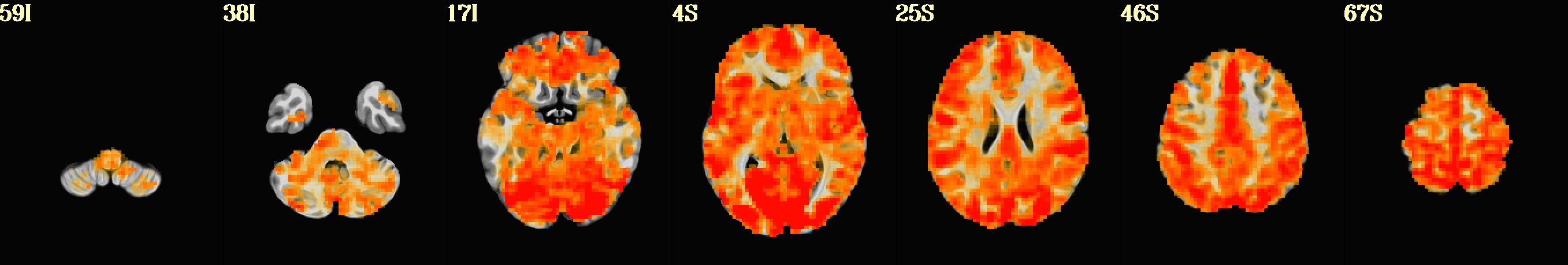 media/qc_21_radcor_rc_regress_d02.axi.jpg
