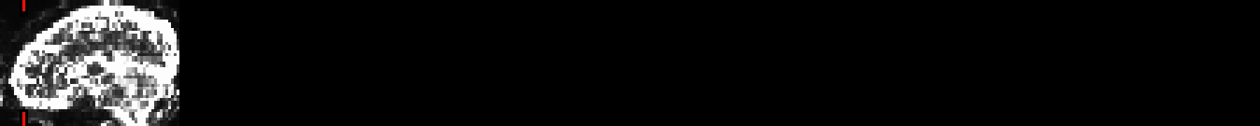 media/qc_28_warns_vlines_0.sag.jpg